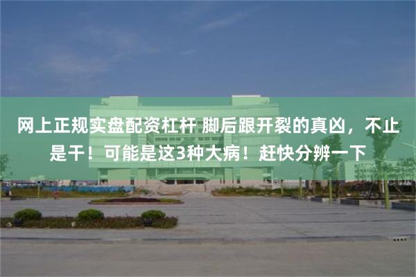 网上正规实盘配资杠杆 脚后跟开裂的真凶，不止是干！可能是这3种大病！赶快分辨一下